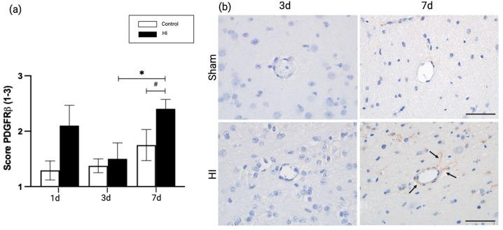 https://cdn.ncbi.nlm.nih.gov/pmc/blobs/be3f/10054605/bf3dee25ab8f/ijms-24-05929-g004.jpg