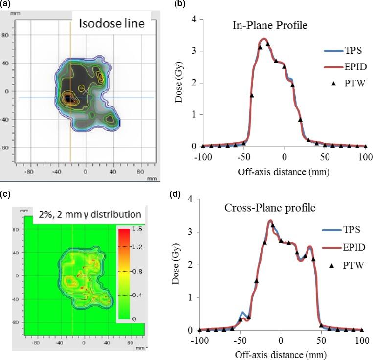 https://cdn.ncbi.nlm.nih.gov/pmc/blobs/be45/5689879/8a4ca51f2c88/ACM2-18-009-g006.jpg