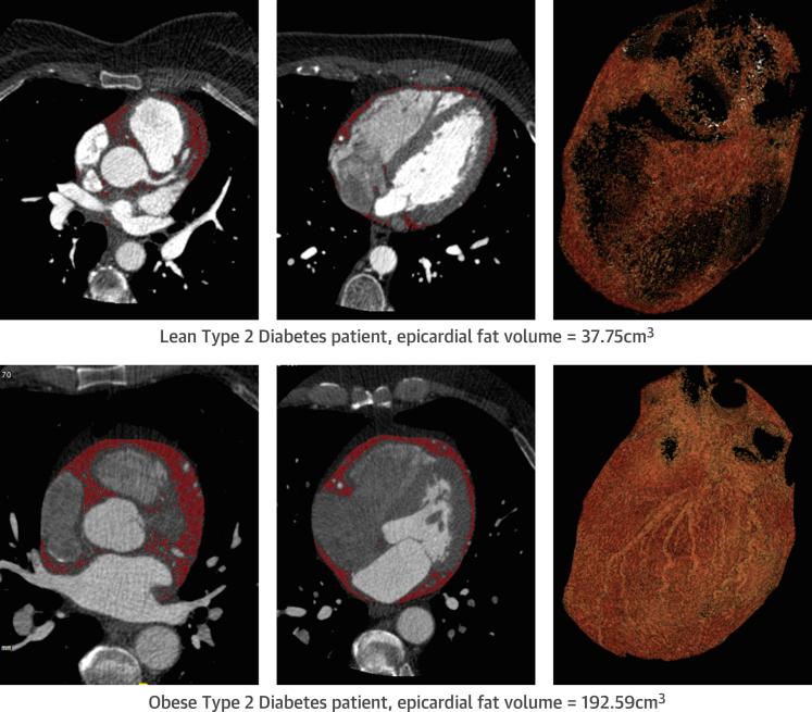 https://cdn.ncbi.nlm.nih.gov/pmc/blobs/be46/4925621/4164f7930c8d/gr3.jpg
