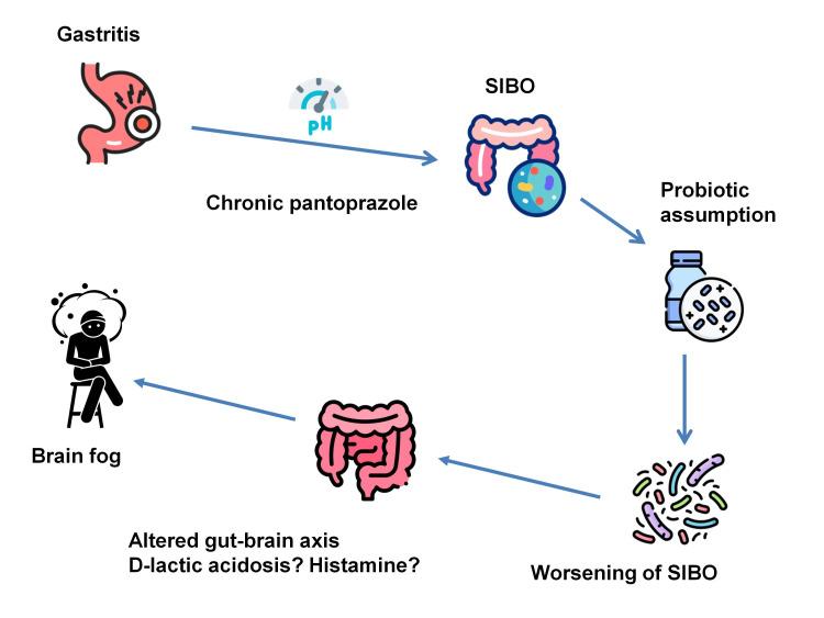 https://cdn.ncbi.nlm.nih.gov/pmc/blobs/be4d/11380651/feadfb820dd3/cureus-0016-00000066426-i01.jpg