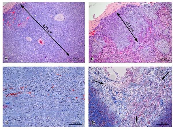 https://cdn.ncbi.nlm.nih.gov/pmc/blobs/be4f/4038722/bc21155de89b/1471-2407-14-338-3.jpg