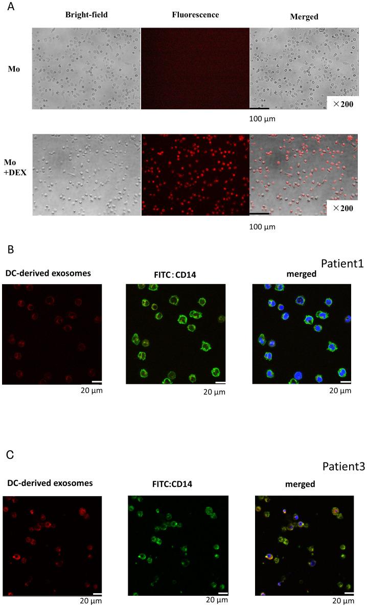 https://cdn.ncbi.nlm.nih.gov/pmc/blobs/be54/12127191/83d758c5a98c/fimmu-16-1565696-g002.jpg