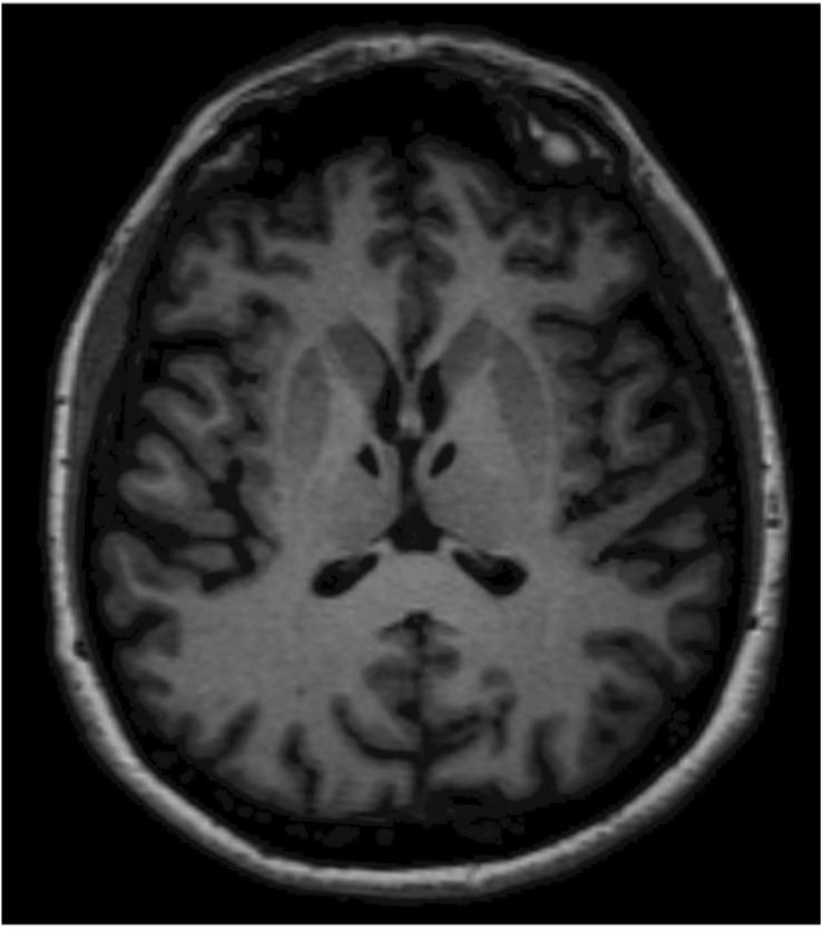 https://cdn.ncbi.nlm.nih.gov/pmc/blobs/be5a/7566041/a62f0075cd51/fpsyg-11-570160-g001.jpg