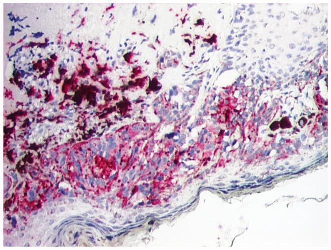 https://cdn.ncbi.nlm.nih.gov/pmc/blobs/be62/7725021/133a9fedc262/etm-21-01-09510-g06.jpg