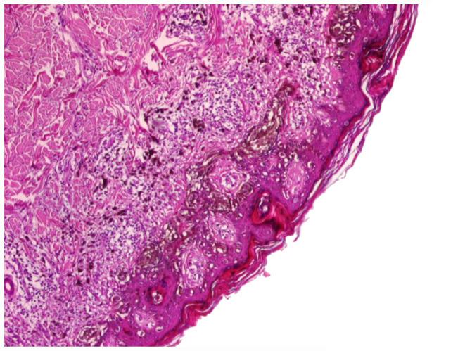 https://cdn.ncbi.nlm.nih.gov/pmc/blobs/be62/7725021/6b62f17fe1ac/etm-21-01-09510-g03.jpg
