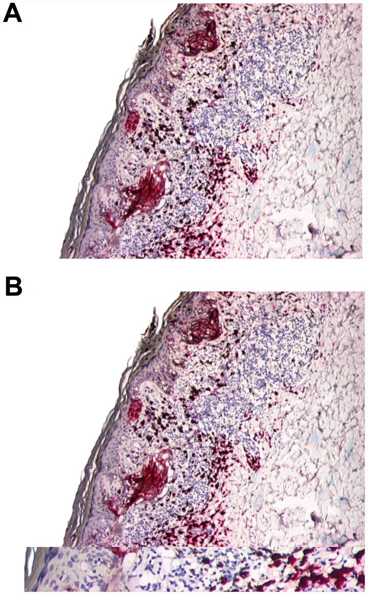 https://cdn.ncbi.nlm.nih.gov/pmc/blobs/be62/7725021/da65bbe7f09e/etm-21-01-09510-g04.jpg