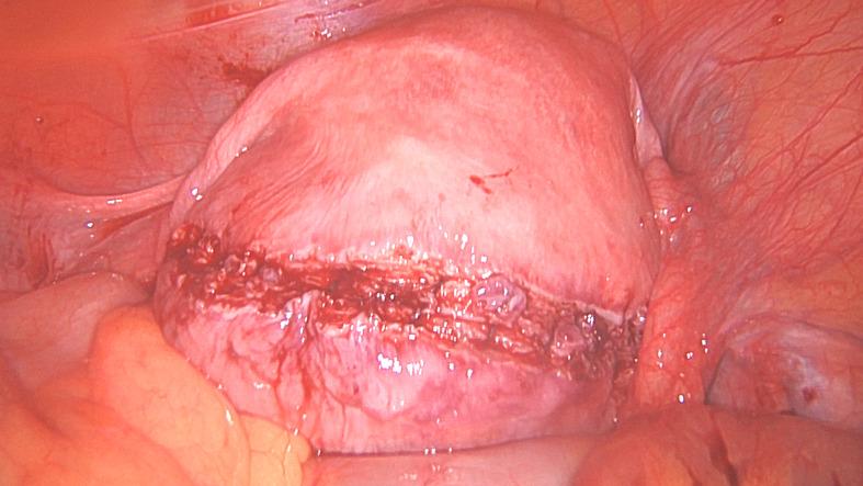 https://cdn.ncbi.nlm.nih.gov/pmc/blobs/be64/11569431/bc3938f548d2/FVVinObGyn-16-263-g001f.jpg