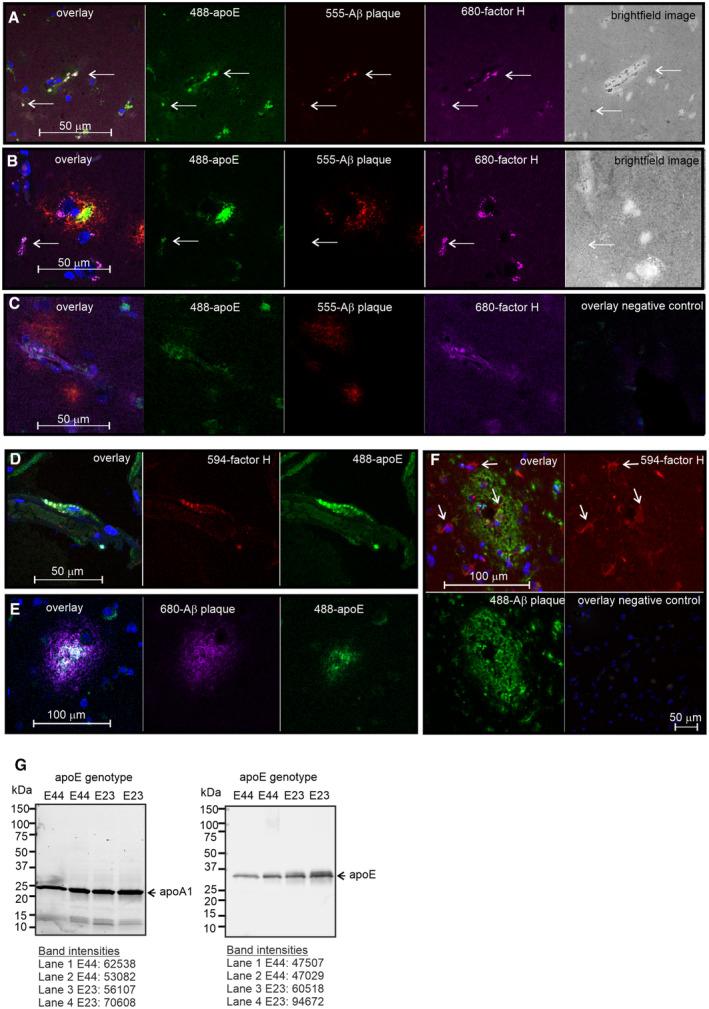 https://cdn.ncbi.nlm.nih.gov/pmc/blobs/be80/10328077/2100fd323102/EMBR-24-e56467-g011.jpg