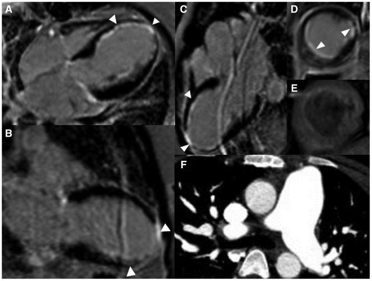 https://cdn.ncbi.nlm.nih.gov/pmc/blobs/be83/7042145/ff4e02570b6c/ytz183f4.jpg