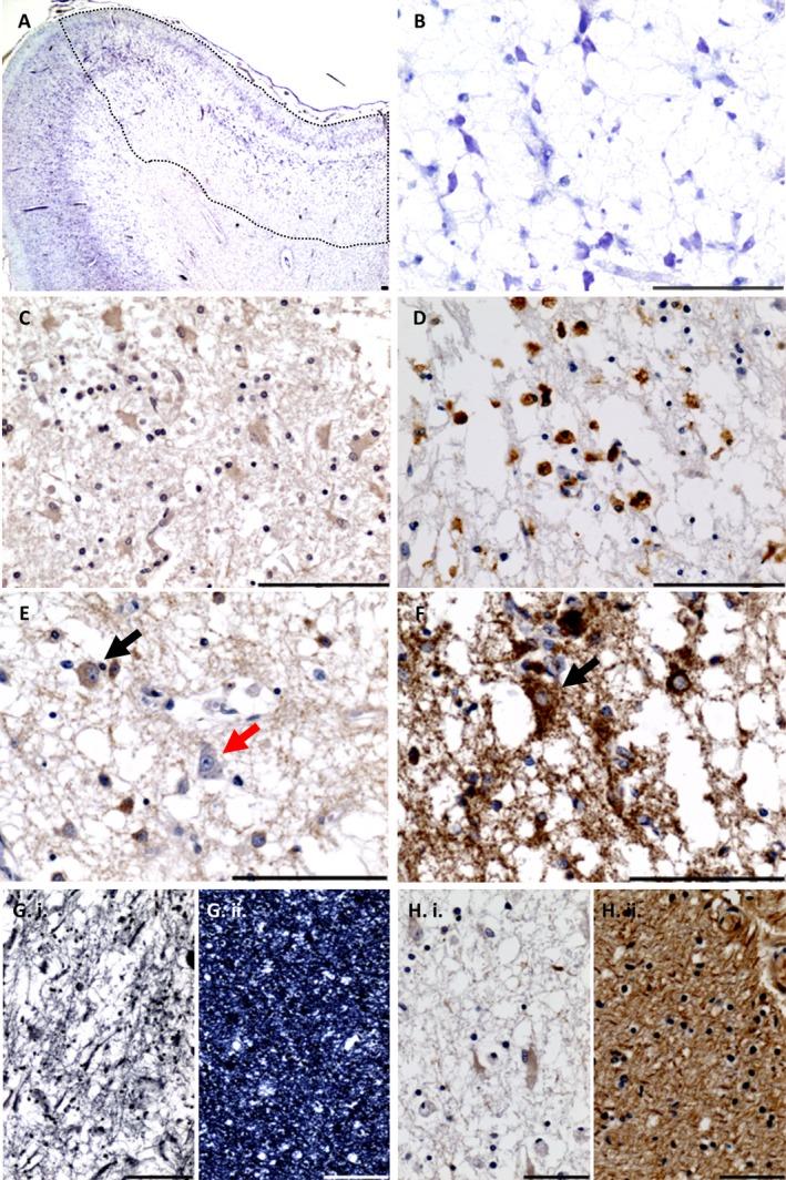https://cdn.ncbi.nlm.nih.gov/pmc/blobs/be89/5363248/4064c9a8a8c8/NAN-43-102-g002.jpg