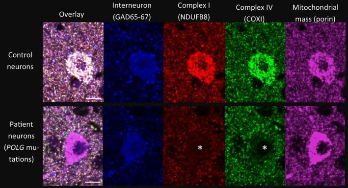 https://cdn.ncbi.nlm.nih.gov/pmc/blobs/be89/5363248/761c9665a0c7/NAN-43-102-g001.jpg