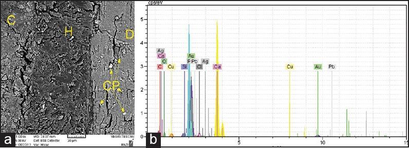 https://cdn.ncbi.nlm.nih.gov/pmc/blobs/be8f/4313474/1a900d38de1f/JCD-18-25-g003.jpg