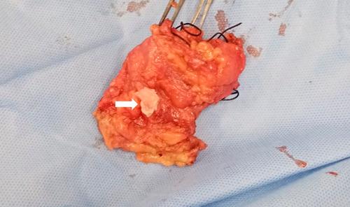 https://cdn.ncbi.nlm.nih.gov/pmc/blobs/be99/10289724/0a2c60a00408/ms9-85-2981-g001.jpg