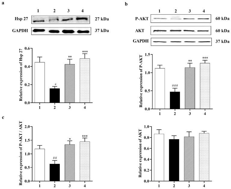 https://cdn.ncbi.nlm.nih.gov/pmc/blobs/be9d/10377037/6ace8d49082e/biomedicines-11-01885-g002.jpg