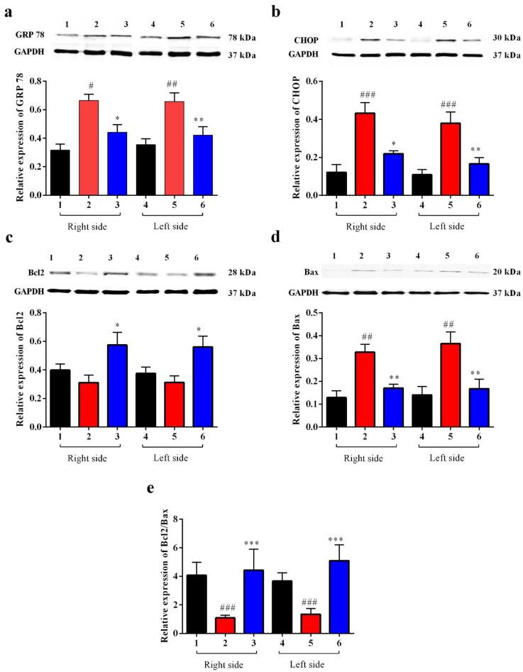 https://cdn.ncbi.nlm.nih.gov/pmc/blobs/be9d/10377037/9674e769a77e/biomedicines-11-01885-g010.jpg