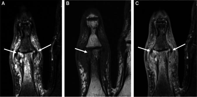 https://cdn.ncbi.nlm.nih.gov/pmc/blobs/be9d/8789645/4a911a29d70e/256_2021_3807_Fig9_HTML.jpg