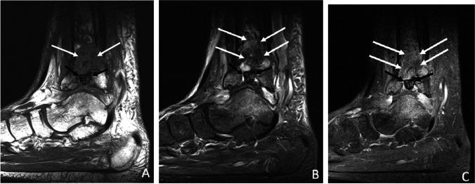 https://cdn.ncbi.nlm.nih.gov/pmc/blobs/be9d/8789645/8533bf6c5dfc/256_2021_3807_Fig19_HTML.jpg