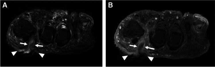 https://cdn.ncbi.nlm.nih.gov/pmc/blobs/be9d/8789645/886837764051/256_2021_3807_Fig3_HTML.jpg