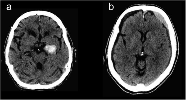 https://cdn.ncbi.nlm.nih.gov/pmc/blobs/be9f/6550144/1e8d344ac1f3/41746_2017_15_Fig5_HTML.jpg