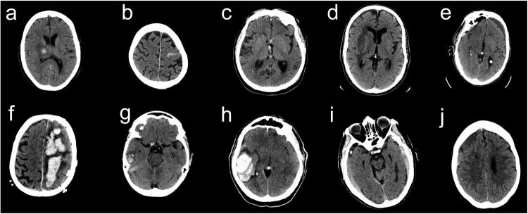 https://cdn.ncbi.nlm.nih.gov/pmc/blobs/be9f/6550144/8c3d3847dea6/41746_2017_15_Fig3_HTML.jpg