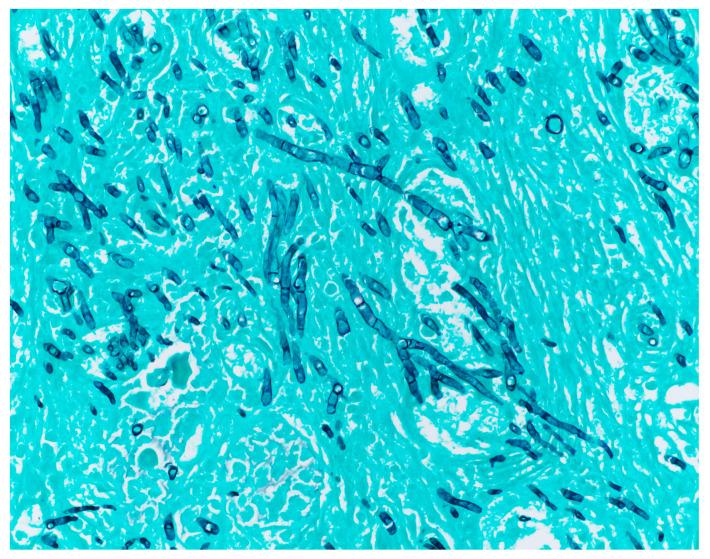 https://cdn.ncbi.nlm.nih.gov/pmc/blobs/bea0/11509022/7ea22d810838/jof-10-00727-g003.jpg