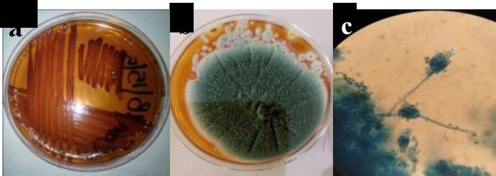 https://cdn.ncbi.nlm.nih.gov/pmc/blobs/bea2/11004782/2035278b3ac1/AJID-18-8-g001.jpg