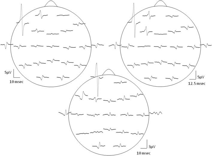 https://cdn.ncbi.nlm.nih.gov/pmc/blobs/beb7/4092367/ae2d6564e564/fnhum-08-00504-g0002.jpg