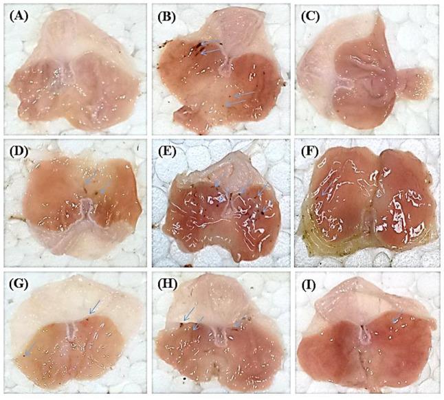 https://cdn.ncbi.nlm.nih.gov/pmc/blobs/beba/9416604/06c3c50cd685/metabolites-12-00750-g002.jpg