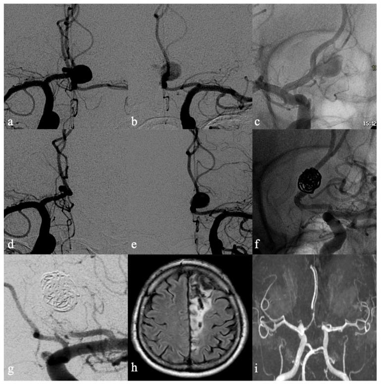 https://cdn.ncbi.nlm.nih.gov/pmc/blobs/bebc/9688233/f4c8a5ad0b7e/brainsci-12-01524-g002.jpg