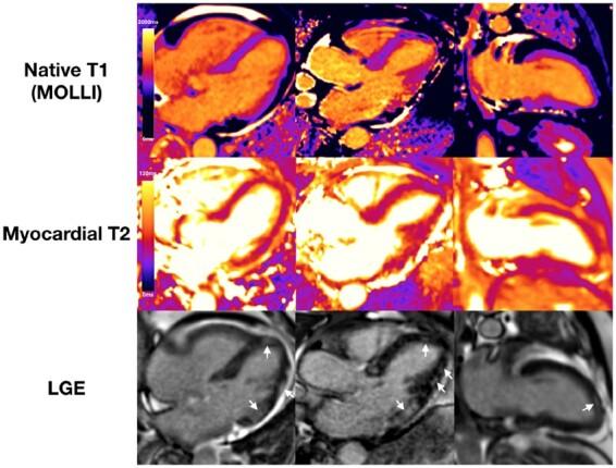 https://cdn.ncbi.nlm.nih.gov/pmc/blobs/bebd/8121552/9ef5a2fc290d/ehab075f3.jpg