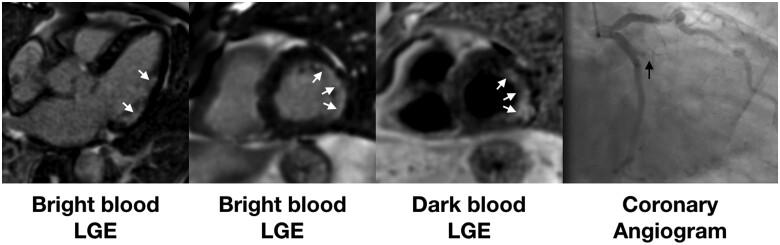 https://cdn.ncbi.nlm.nih.gov/pmc/blobs/bebd/8121552/bc63063a2e67/ehab075f4.jpg