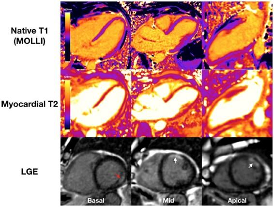 https://cdn.ncbi.nlm.nih.gov/pmc/blobs/bebd/8121552/d38544da5f53/ehab075f6.jpg