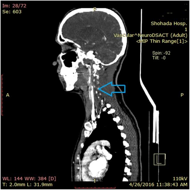 https://cdn.ncbi.nlm.nih.gov/pmc/blobs/bec6/5338895/415d20585548/gr2.jpg
