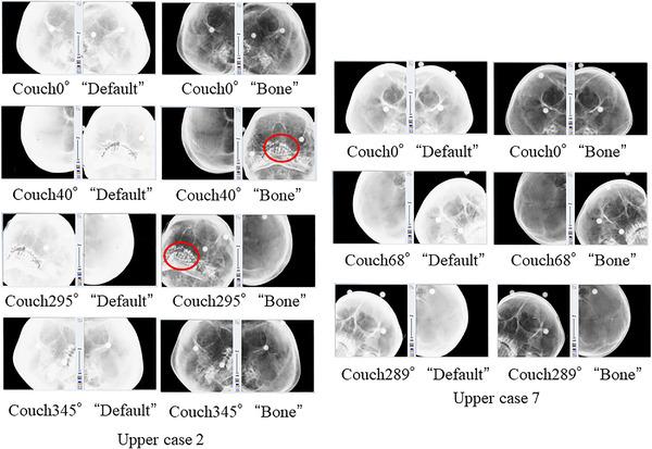 https://cdn.ncbi.nlm.nih.gov/pmc/blobs/bec7/8833277/69f9b61266cb/ACM2-23-e13505-g009.jpg