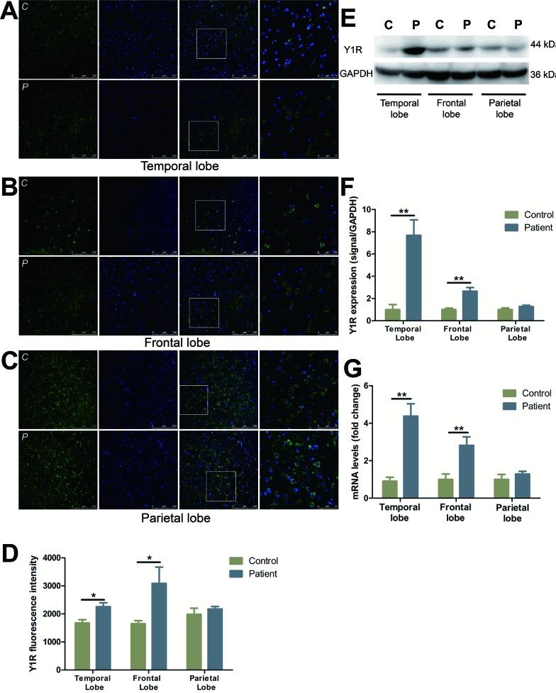 https://cdn.ncbi.nlm.nih.gov/pmc/blobs/bed2/4941244/292f9932f909/oncotarget-07-15329-g001.jpg
