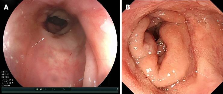 https://cdn.ncbi.nlm.nih.gov/pmc/blobs/bed2/7052549/e12628decb4f/WJCC-8-790-g004.jpg