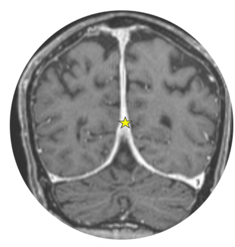 https://cdn.ncbi.nlm.nih.gov/pmc/blobs/bed7/11684790/ebcd5b59081e/cureus-0016-00000074853-i07.jpg