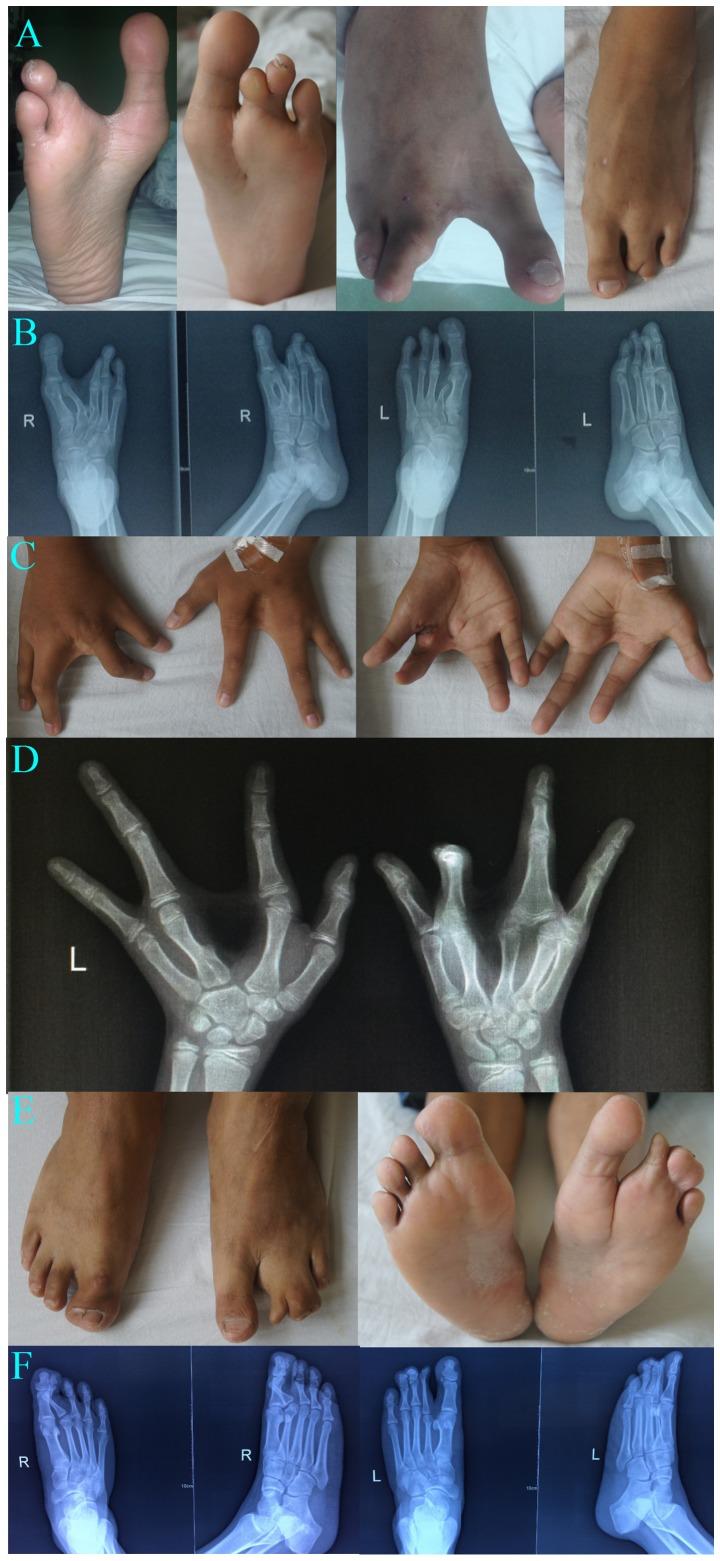 https://cdn.ncbi.nlm.nih.gov/pmc/blobs/beda/5983954/33441818a056/MMR-17-06-7553-g01.jpg