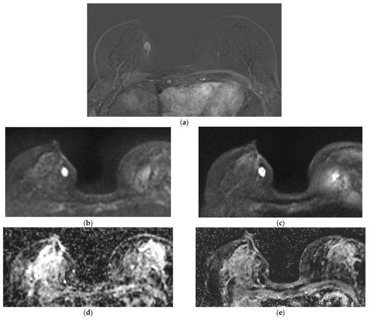 https://cdn.ncbi.nlm.nih.gov/pmc/blobs/bedc/11353399/601a04e0d65f/diagnostics-14-01742-g002.jpg