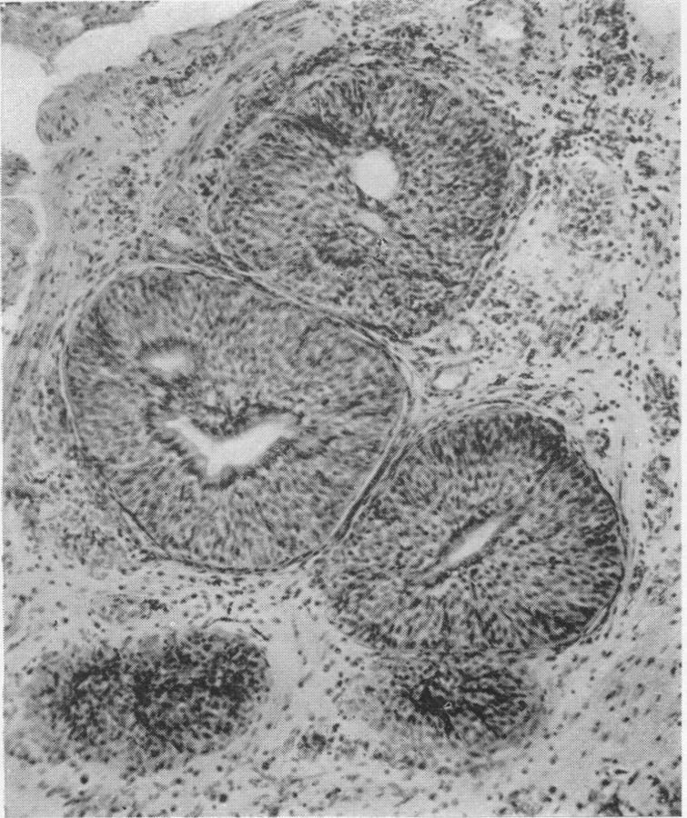 https://cdn.ncbi.nlm.nih.gov/pmc/blobs/bee0/1399891/9842f412a725/annsurg00714-0125-a.jpg