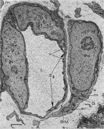 https://cdn.ncbi.nlm.nih.gov/pmc/blobs/bee1/1310317/9169ac566003/taos00033-0817-a.jpg