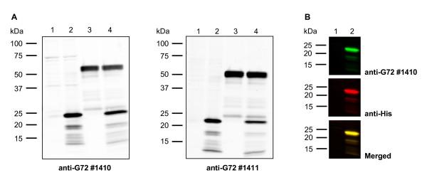 https://cdn.ncbi.nlm.nih.gov/pmc/blobs/beed/2630984/fbf5c7afaef7/1471-244X-8-94-4.jpg