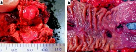 https://cdn.ncbi.nlm.nih.gov/pmc/blobs/bef0/5704026/4581457e2662/40792_2017_392_Fig3_HTML.jpg