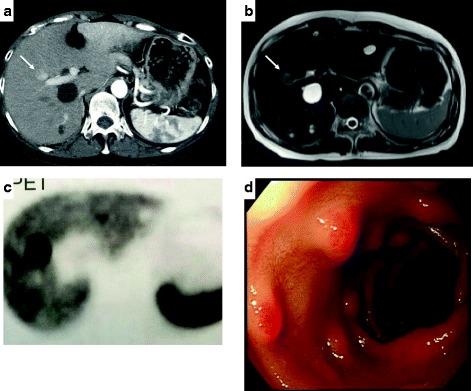 https://cdn.ncbi.nlm.nih.gov/pmc/blobs/bef0/5704026/ed2e777c02f5/40792_2017_392_Fig1_HTML.jpg