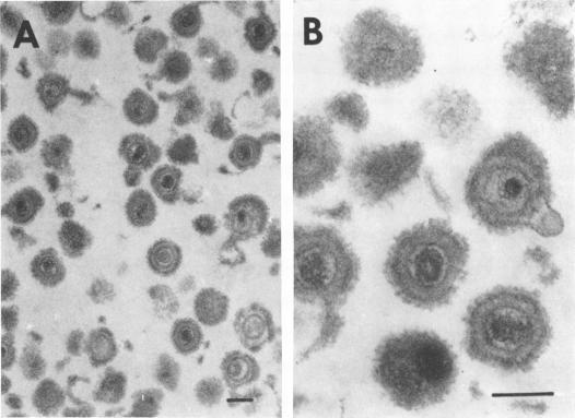 https://cdn.ncbi.nlm.nih.gov/pmc/blobs/bef5/356272/de99ba846f41/jvirol00265-0157-a.jpg