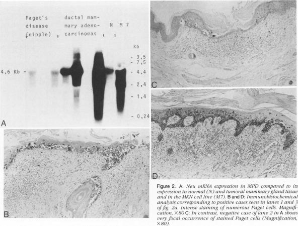 https://cdn.ncbi.nlm.nih.gov/pmc/blobs/befe/1877726/c2ae99c56c95/amjpathol00108-0039-a.jpg