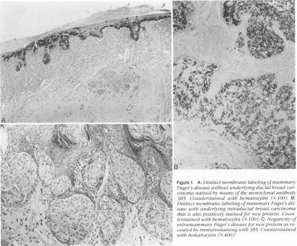 https://cdn.ncbi.nlm.nih.gov/pmc/blobs/befe/1877726/f15f57b03987/amjpathol00108-0038-a.jpg