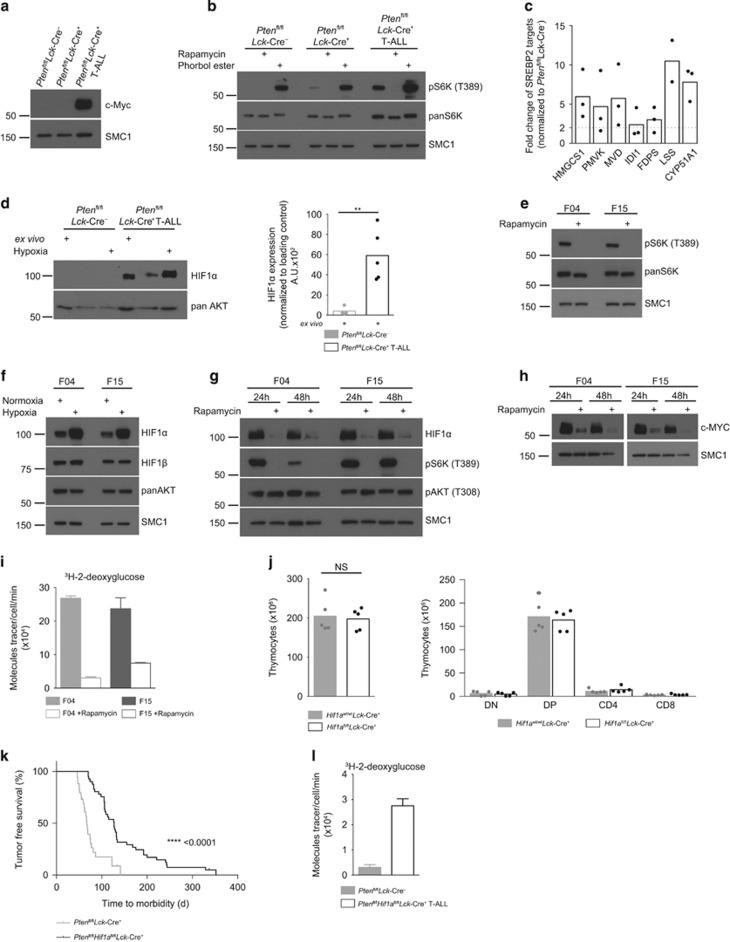 https://cdn.ncbi.nlm.nih.gov/pmc/blobs/bf00/5729345/1645c661f824/leu2017160f3.jpg