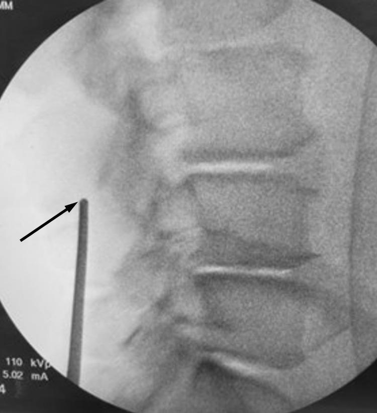 https://cdn.ncbi.nlm.nih.gov/pmc/blobs/bf04/10463371/59d558f6a485/JPR-16-2909-g0001.jpg