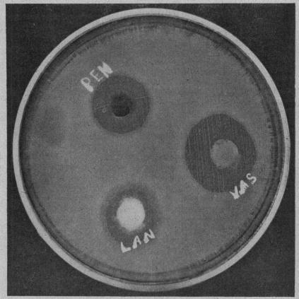 https://cdn.ncbi.nlm.nih.gov/pmc/blobs/bf08/510510/390dab0ab077/brjopthal00685-0053-a.jpg
